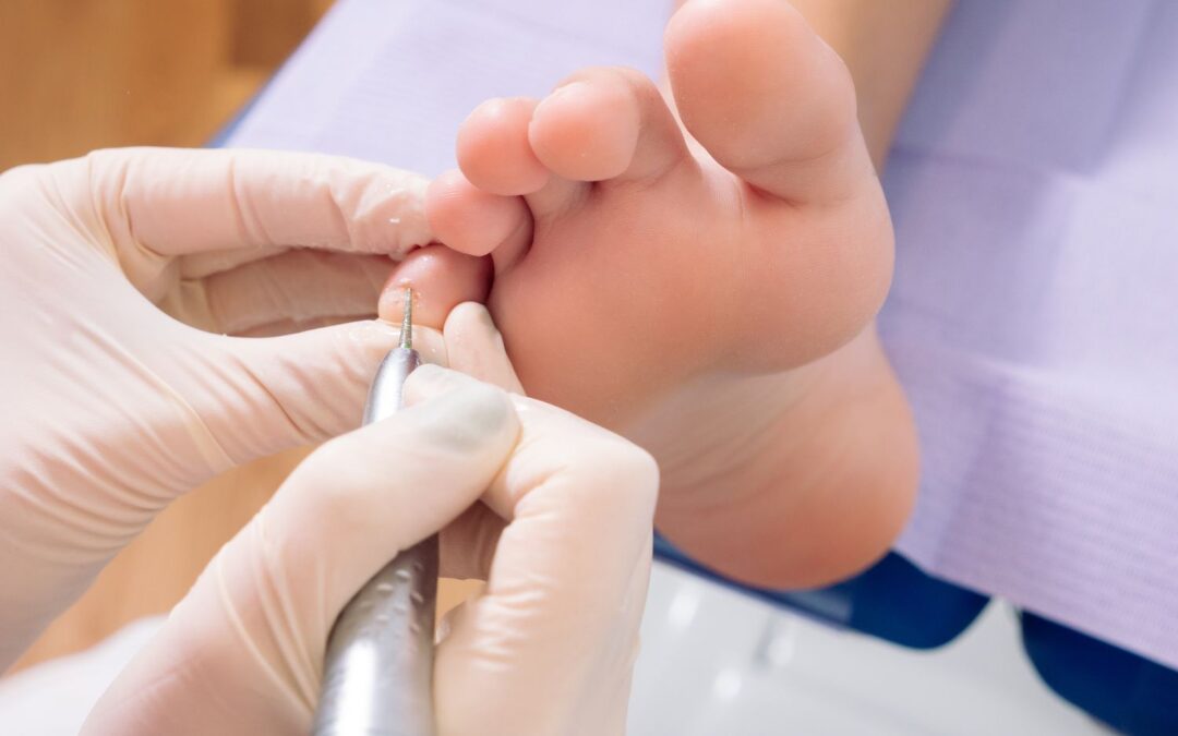 5 Tips for Maintaining Foot and Nail Health as You Age: Expert Advice from a Podiatrist